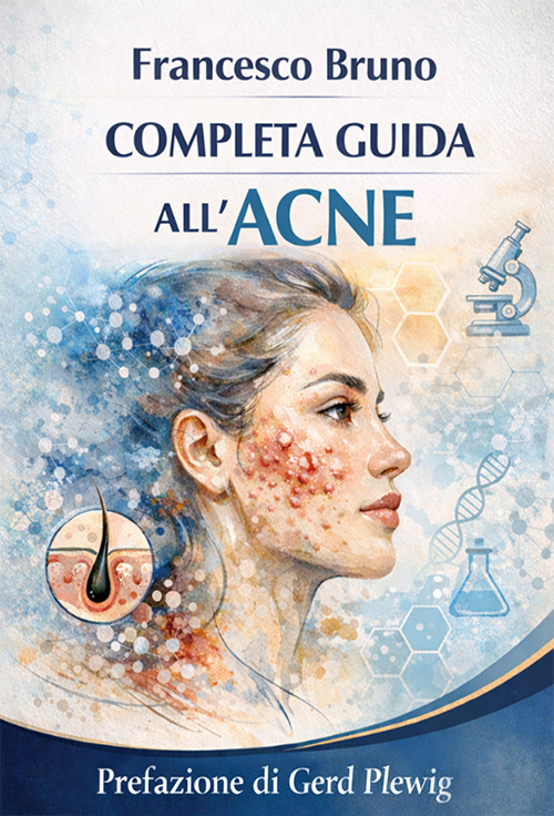 Completa Guida all'ACNE