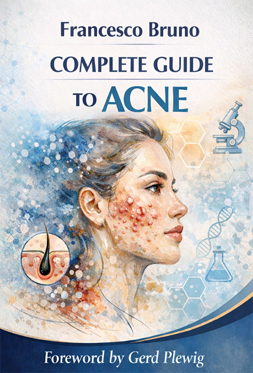 Completa Guida all'ACNE