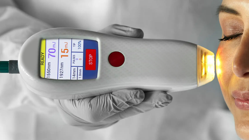 Multifrax Laser Frazionato non ablativo