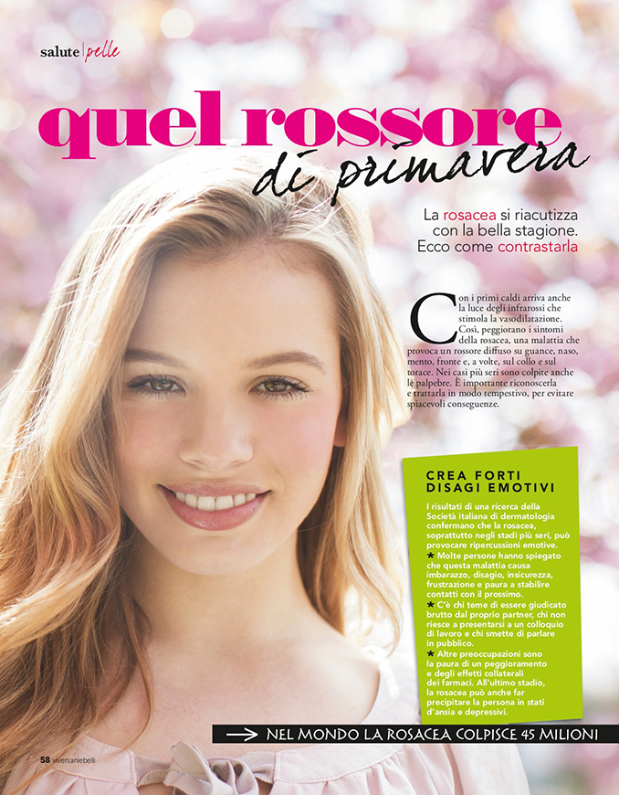 Rosacea, quel rossore di primavera Rosacea, quel rossore di primavera